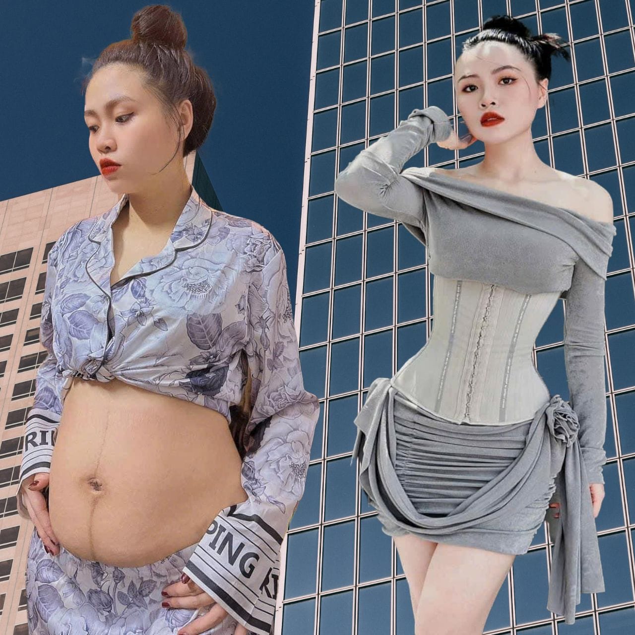 Latex Giảm Mỡ Bụng Sau Sinh Hiệu Quả